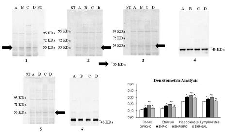 Vacht Western Blots Analysis In Frontal Cortex Blot 1 Striatum Blot