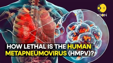 Human metapneumovirus | TristonCatriona