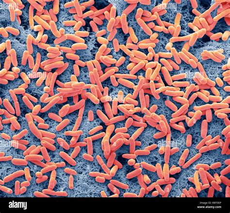 E Coli Bacteria Coloured Scanning Electron Micrograph Of The Rod