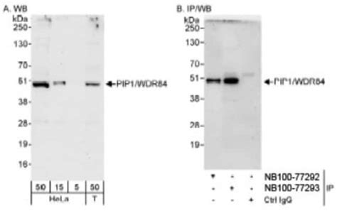 PAK1 Interacting Protein 1 Antibody Novus Biologicals 0 02mg