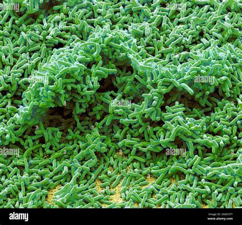 Pseudomonas Bacteria Coloured Scanning Electron Micrograph SEM Of