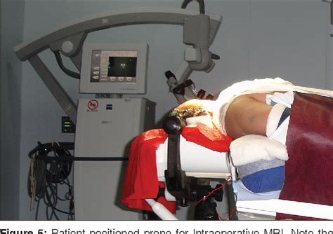 Table From Intraoperative Magnetic Resonance Imaging For Neurosurgery