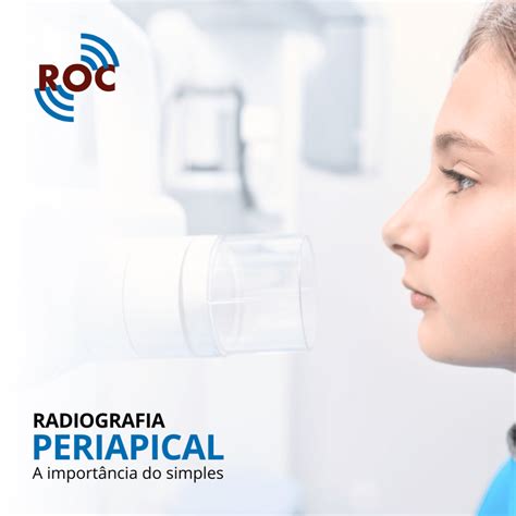 Radiografia Periapical A Importância do Simples ROC