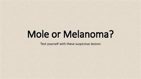 Mole Or Melanoma Test Yourself With These Suspicious