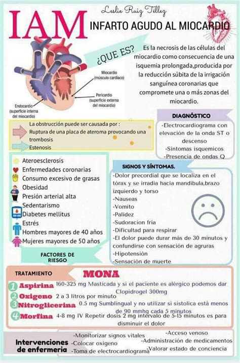 Infarto Agudo Del Miocardio