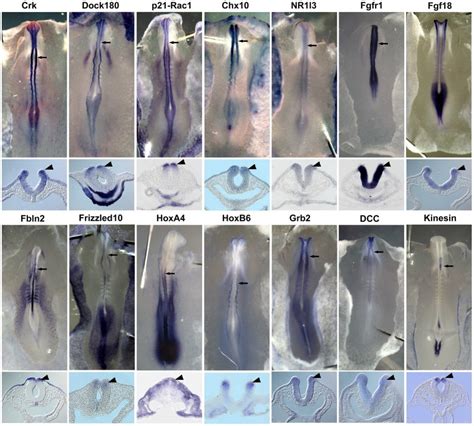 Whole Mount In Situ Hybridization Was Performed Using Rna Probes