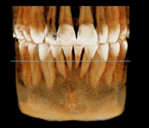 Tomografia Z B W Cefalometria Pantomogram Cbct Stomatologia