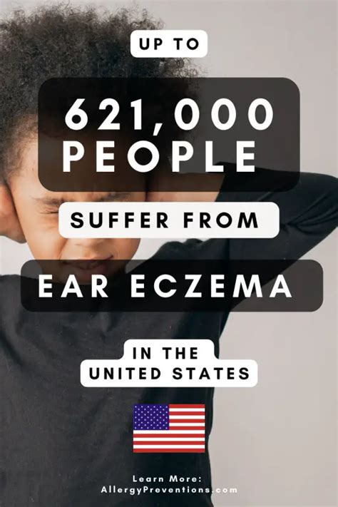 Complete Ear Eczema Guide Causes Symptoms Treatments And More