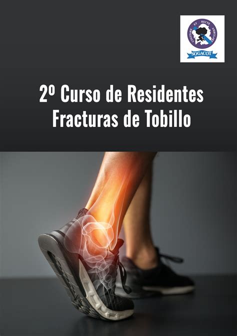 2º Curso de Residentes SOGACOT Fracturas de Tobillo SOGACOT