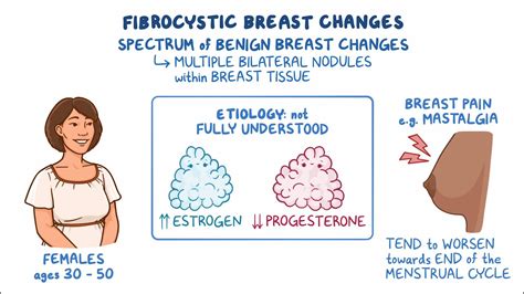 Breast Disease