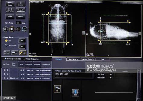 Gamma Ray Scanner Photos And Premium High Res Pictures Getty Images