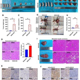 Low Expression Of Ddx Promoted Crc Cell Proliferation In Vitro A