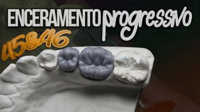 Anatomia e Escultura Dental Enceramento Diagnóstico 2 Pré Molar e 1