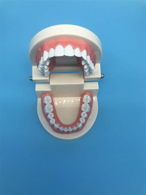 Mod Le D Tude Dentaire Orthodontique Dentaire Pour L Enseignement