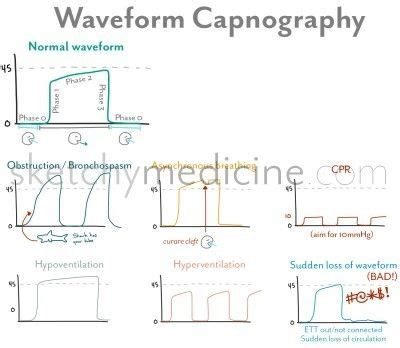 Pharmacology Nursing, Icu Nursing, Nursing Study, Nursing Tips, Nursing ...