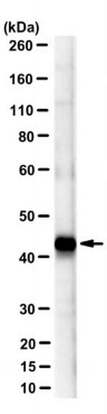 Anti β Dystroglycan Antibody Clone 7d11 Mabt1546 25ug