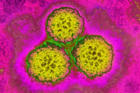 What Are The Symptoms Of Anal Cancer Disease Is On The Rise In The U S
