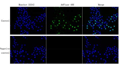 Cell State Detection Project Cellular Proliferation And Apoptosis