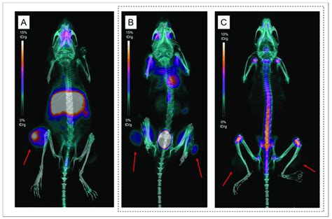 Positron Emission Tomography PET Imaging With 89 Zr DFO 9E7 4 18