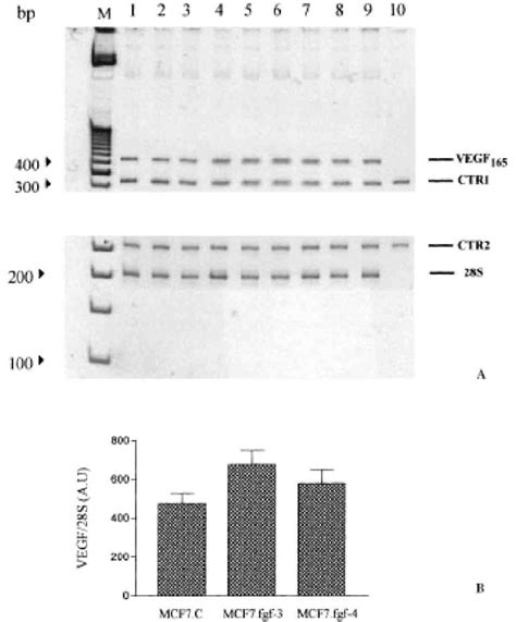 Expression Of Vegf 165 Mrna A Mrnafor Vegf 165 Was Measured By