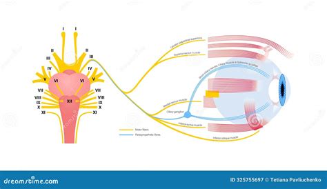 Oculomotor Nerve Palsy Cartoon Vector Cartoondealer