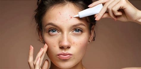 La Migliore Crema Per Acne E Brufoli Del 2025