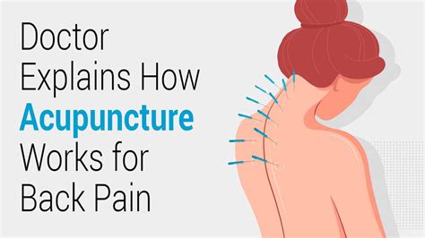 How Acupuncture Actually Works for Back Pain? A Doctor Explains