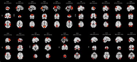 Frontiers Abnormal Static And Dynamic Functional Network Connectivity