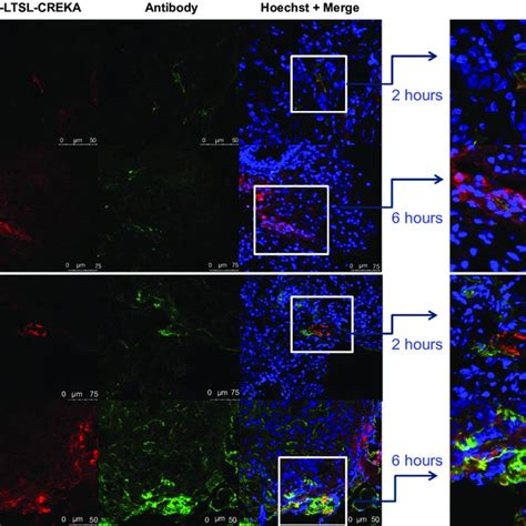 In Vivo Imaging Notes The Mcf 7 Adr Tumor Bearing Mice Received An