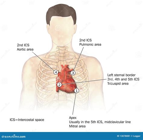 Heart auscultation stock vector. Illustration of science - 13078081