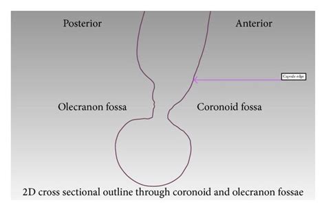 The Outline Of The Synovial Membranes Sm Insertion On The 3d Image