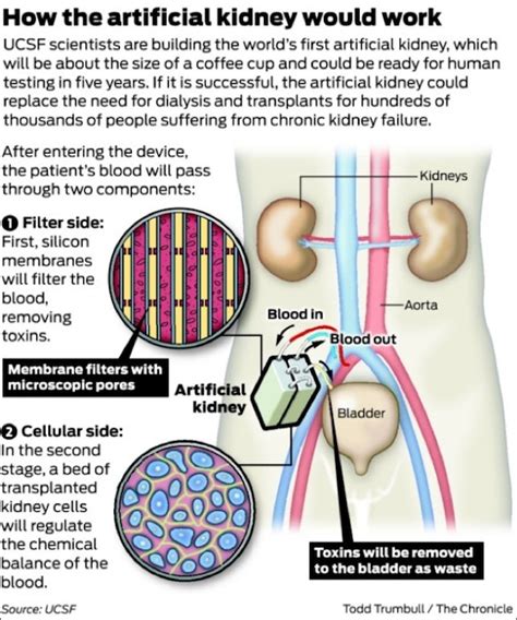 eNLokam: Artificial Kidney an Indian Move!!!