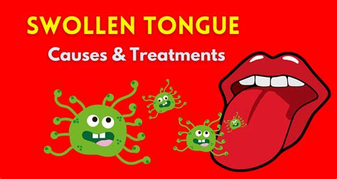 Swollen Tongue Causes & Treatments - TheLotusTower.com