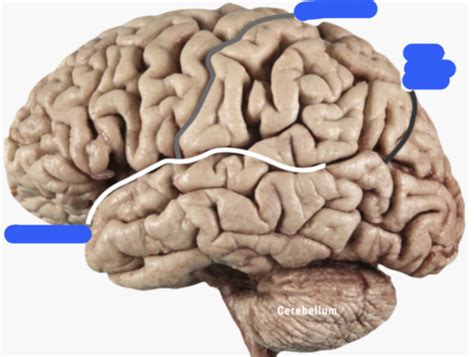 Kin 411 Lecture 2 3 Gross Neuroanatomy Of Brain Flashcards Quizlet