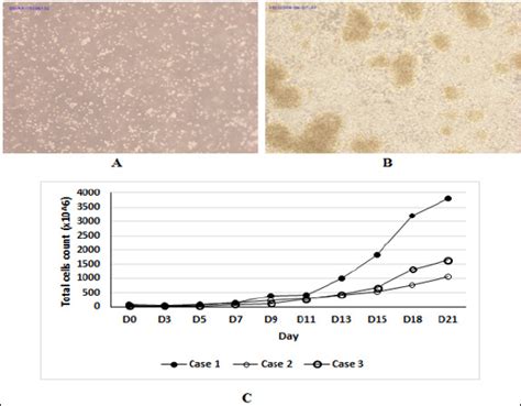 Efficient Expansion Of Human Umbilical Cord Blood Derived Nk Cells Ex