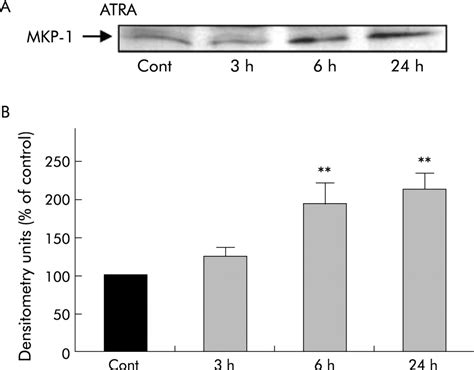 Vitamin A Inhibits Pancreatic Stellate Cell Activation Implications For Treatment Of Pancreatic