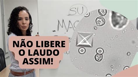 COMO LAUDAR SUMÁRIO DE URINA CORRETAMENTE Sedimentoscopia YouTube