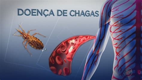 Passos e São Sebastião do Paraíso concentram casos de doenças de Chagas