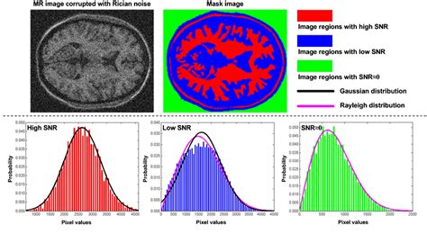 Figure From Generalized Total Variation Based Mri Rician Denoising