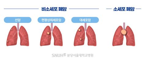 Null분당서울대학교병원