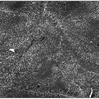 Sem Micrograph Showing Microstructure Of The Weld Zone W Mm S