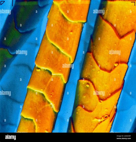 False Colour Scanning Electron Micrograph Sem Of Two Strands Of