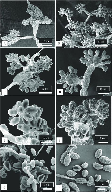 Scanning Electron Micrographs Of Conidiophores And Conidia Of Two