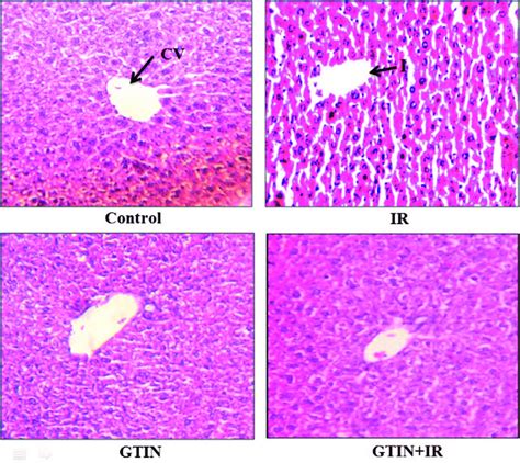 Histological Sections Of Liver Sections Were Stained With H And E Download Scientific Diagram