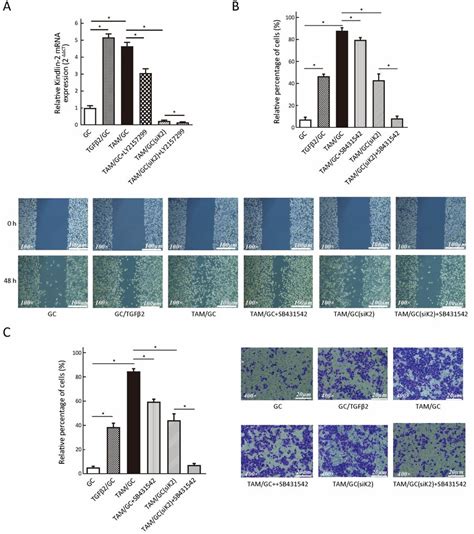 Figure S1 Comparison Of Kindlin 2 Expression Or Cell Invasive Ability