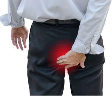 Anal Itching Causes And Treatment