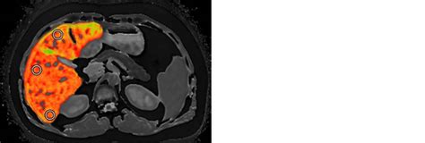 Contact Us Partners Imaging Centers 3T MRI CT X Ray PET Mammo