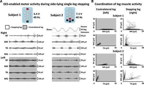 Electrophysiological Guidance Of Epidural Electrode Array Implantation Over The Human