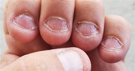 Tips To Stop Biting Your Nails Once And For All Bright Side