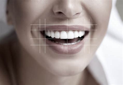 The Anatomy Of The Smile By Dr Jelušić Part Three Institute